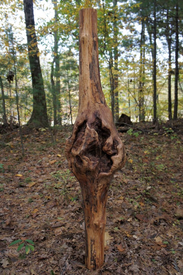 linda hoffman's beforecancerafter